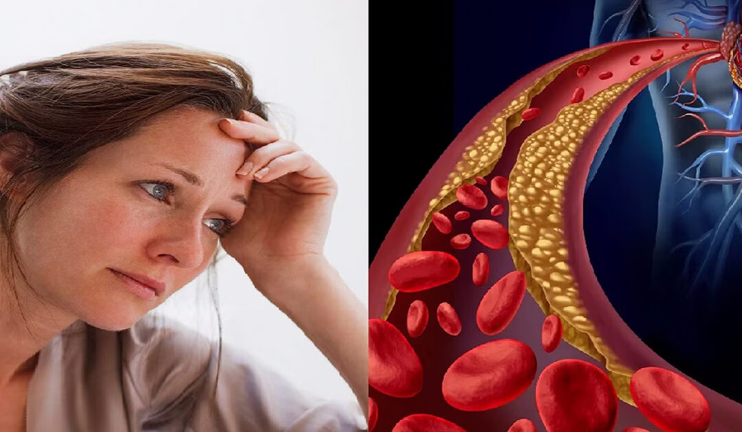 Doctor’s Lie About Statins and Cholesterol