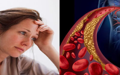 Doctor’s Lie About Statins and Cholesterol