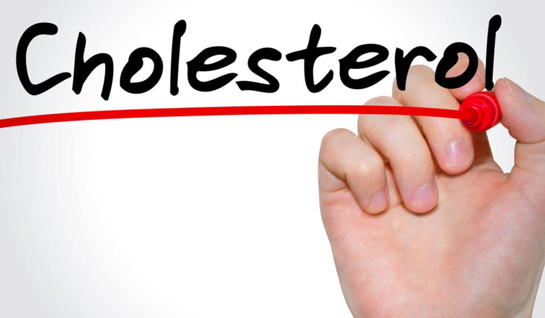 A Brief History of Cholesterol: From Guidelines to Statins