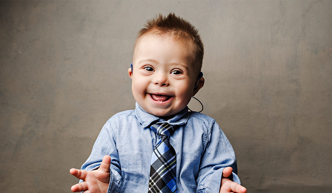 Supporting Individuals with Down Syndrome