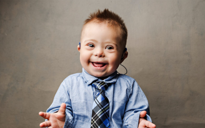 Supporting Individuals with Down Syndrome
