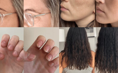 Collagen: Which Type is Best forYour Skin and Overall Health?
