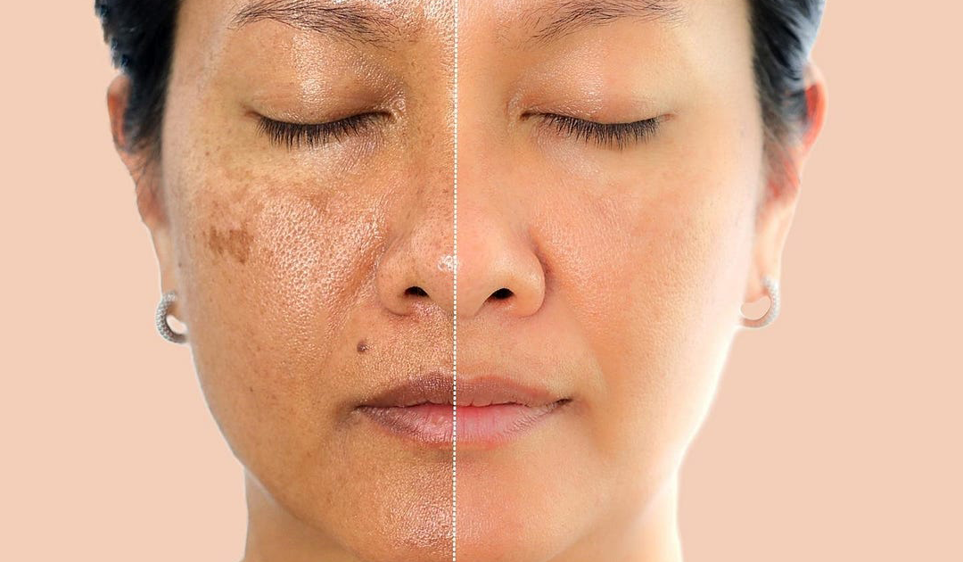 A Monthly Ritual for Radiant Skin, Stronger Joints, and Proactive Aging