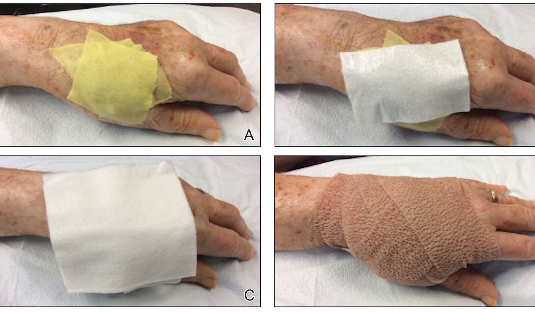 Faster Wound Healing