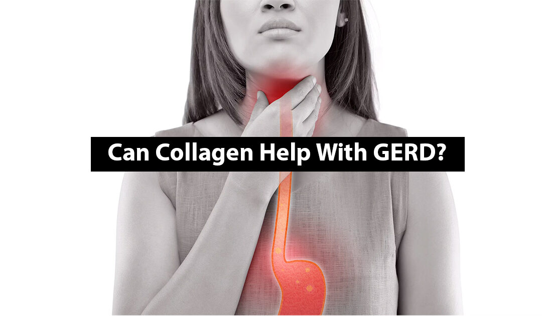 Can Collagen Help With GERD? Here’s the Promising Connection